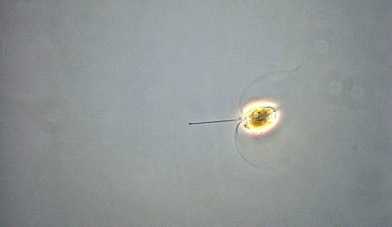 What we know about  “the algae of death”