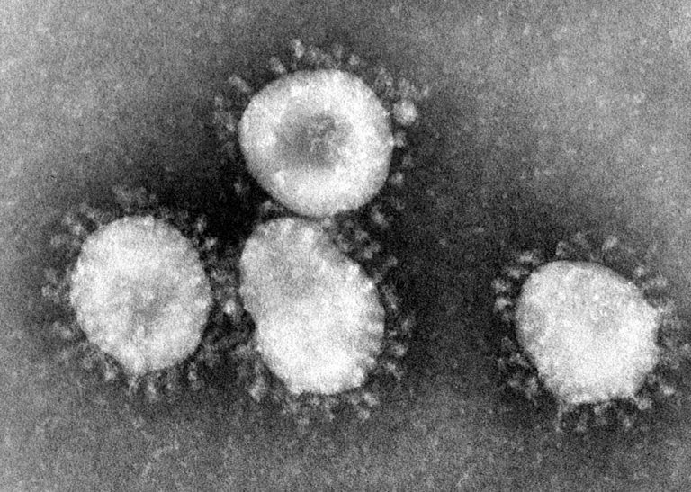 Scottish exports to China are slowing because of coronavirus, confirms SSPO