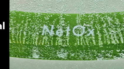 NETOX-alt-980×300-med-messe-2