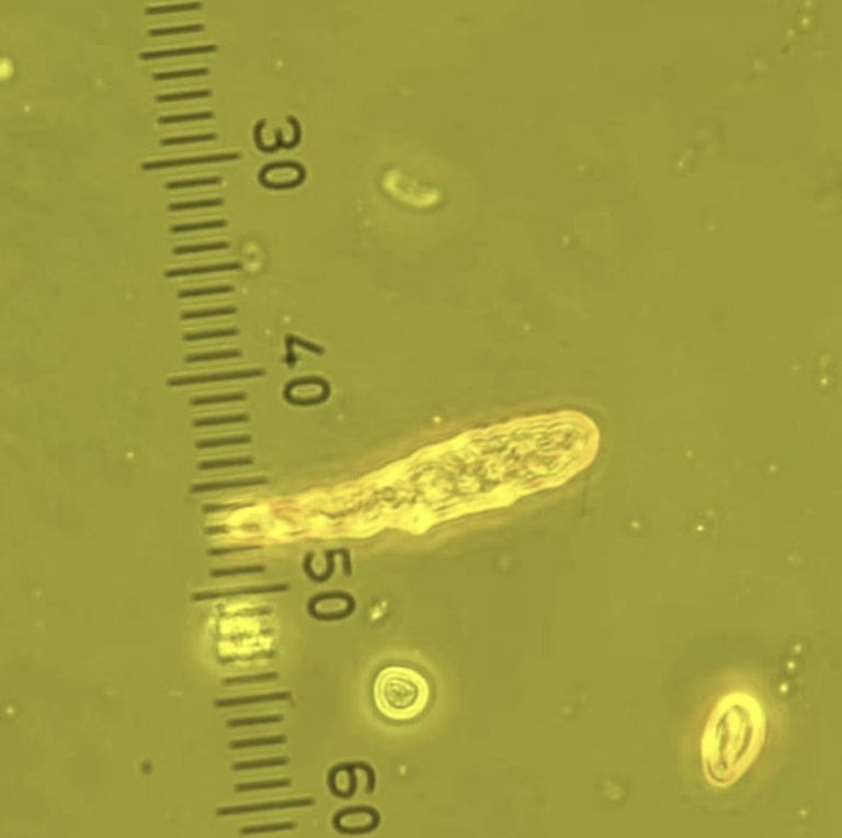 Algae outbreak moves south, putting salmon farms on alert