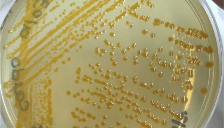 Researchers: new Flavobacterium strain isolated from hatchery water