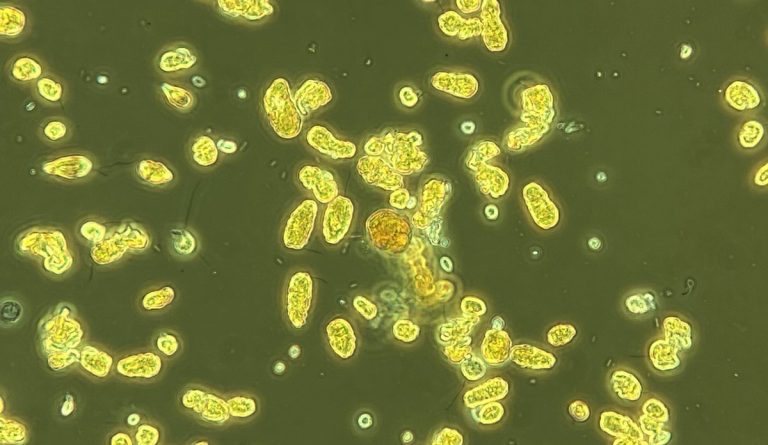 Week 14 status update: harmful algae present but below danger levels